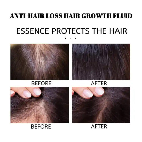 Hair Care Essential Oil Disposable Hair Care Solution - Image 2