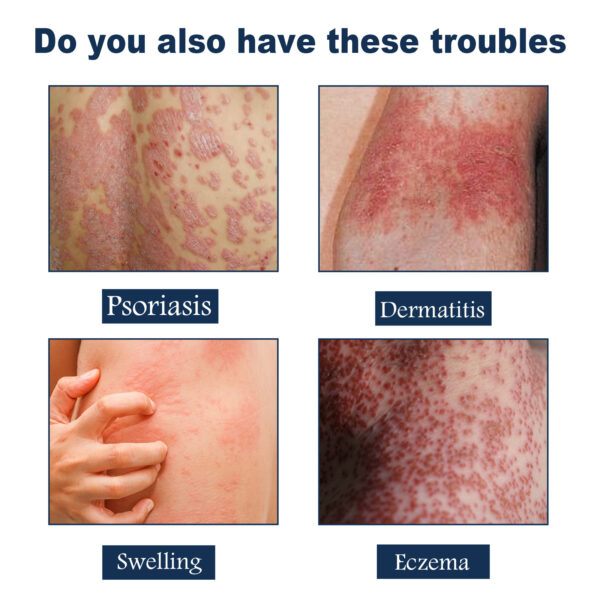Body Care Spray Relieves - Image 3