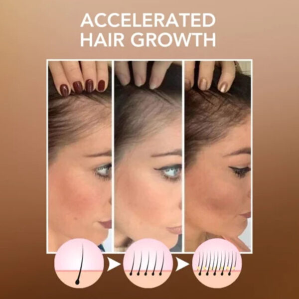 HOEGOA Moroccan Hair Care Disposable Hair Care - Image 2